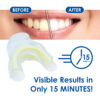 Medidenta - Whiter Image - 9% HP - Prefilled Teeth Whitening Tray - 03