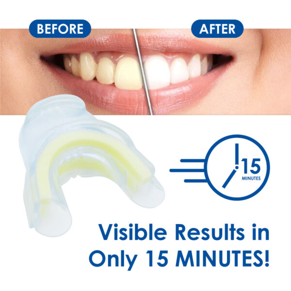 Medidenta - Whiter Image - 9% HP - Prefilled Teeth Whitening Tray - 03