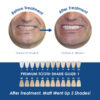 Medidenta - Whiter Image - 9% HP - Prefilled Teeth Whitening Tray - 07