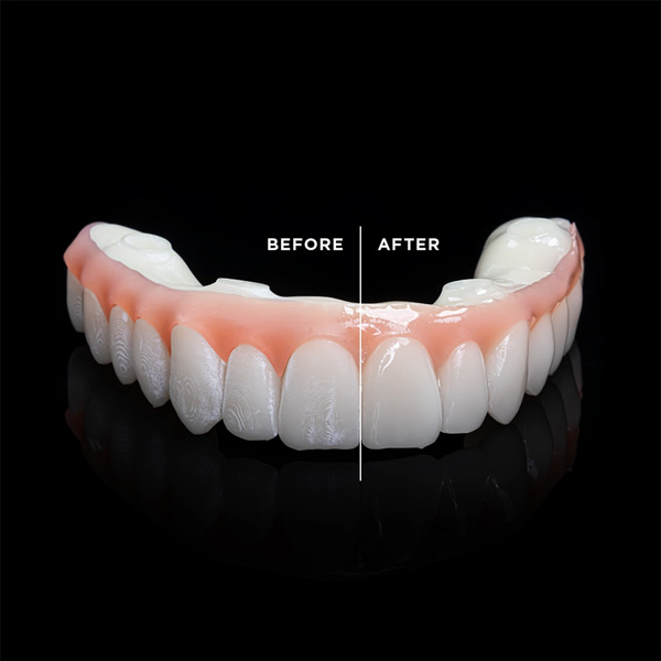 Nifty Medidenta - 3D Printing - Resins - Rodin® Glaze N2-Free Gallery 03