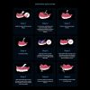 Nifty Medidenta - 3D Printing - Resins - Rodin® Soft Reline Kit - Gallery 03