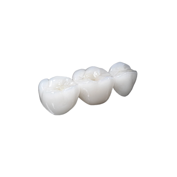 Nifty Medidenta - 3D Printing - Resins - Rodin® RapidCeram - Gallery 02