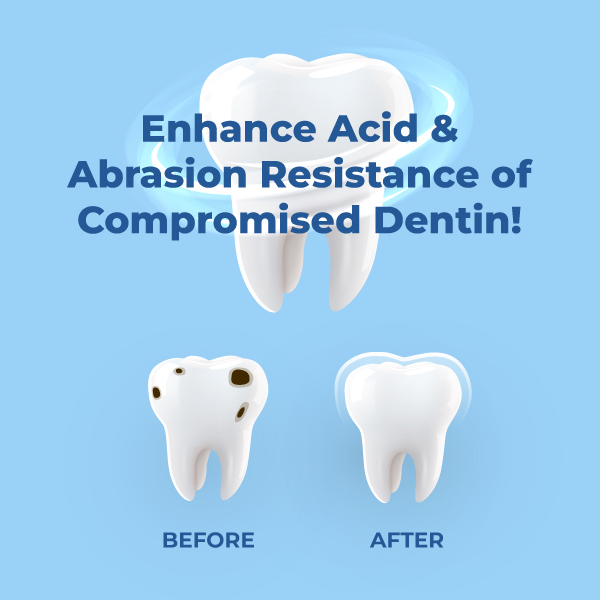 Nifty Medidenta - SDF Pro™ 38% Silver Diamine Fluoride Solution Bottle Kit - Gallery 04